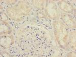 SAV1 Antibody in Immunohistochemistry (Paraffin) (IHC (P))