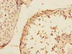 UBE2Z Antibody in Immunohistochemistry (Paraffin) (IHC (P))