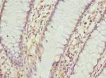 PLGRKT Antibody in Immunohistochemistry (Paraffin) (IHC (P))