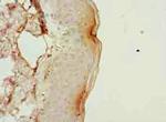 PLGRKT Antibody in Immunohistochemistry (Paraffin) (IHC (P))