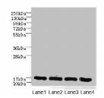 PLGRKT Antibody in Western Blot (WB)