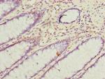 VAT1L Antibody in Immunohistochemistry (Paraffin) (IHC (P))