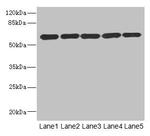 ARHGEF3 Antibody in Western Blot (WB)