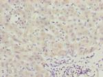 CALCOCO1 Antibody in Immunohistochemistry (Paraffin) (IHC (P))