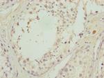 CALCOCO1 Antibody in Immunohistochemistry (Paraffin) (IHC (P))