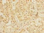 ALS2CR1 Antibody in Immunohistochemistry (Paraffin) (IHC (P))