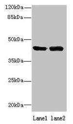 ALS2CR1 Antibody in Western Blot (WB)