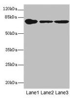 FZD3 Antibody in Western Blot (WB)