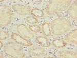 IL17RB Antibody in Immunohistochemistry (Paraffin) (IHC (P))