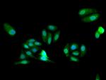 FARSB Antibody in Immunocytochemistry (ICC/IF)