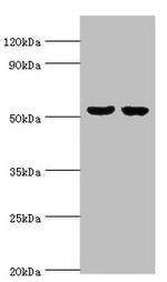 GBA3 Antibody in Western Blot (WB)