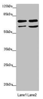 VPS33B Antibody in Western Blot (WB)