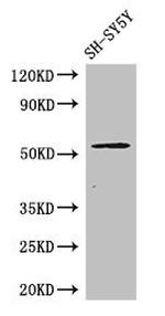 METTL14 Antibody in Western Blot (WB)