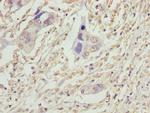 VPS25 Antibody in Immunohistochemistry (Paraffin) (IHC (P))