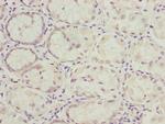 NLE1 Antibody in Immunohistochemistry (Paraffin) (IHC (P))