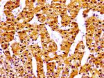 NPC1 Antibody in Immunohistochemistry (Paraffin) (IHC (P))