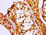 NPC1 Antibody in Immunohistochemistry (Paraffin) (IHC (P))