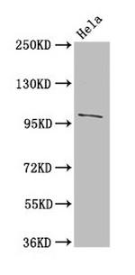 NPC1 Antibody in Western Blot (WB)