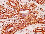 PACSIN2 Antibody in Immunohistochemistry (Paraffin) (IHC (P))