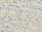 PACSIN2 Antibody in Immunohistochemistry (Paraffin) (IHC (P))