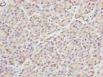 PACSIN2 Antibody in Immunohistochemistry (Paraffin) (IHC (P))