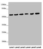 PACSIN2 Antibody in Western Blot (WB)