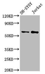 MGAT4B Antibody in Western Blot (WB)