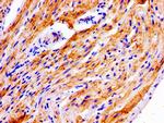 NDRG4 Antibody in Immunohistochemistry (Paraffin) (IHC (P))