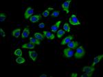 SNX12 Antibody in Immunocytochemistry (ICC/IF)