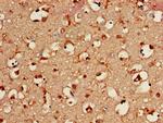 BAIAP2 Antibody in Immunohistochemistry (Paraffin) (IHC (P))