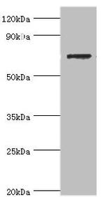 SLC25A13 Antibody in Western Blot (WB)