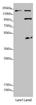 MYO5B Antibody in Western Blot (WB)