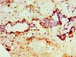 PADI2 Antibody in Immunohistochemistry (Paraffin) (IHC (P))