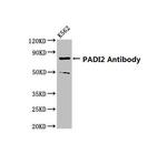 PADI2 Antibody in Western Blot (WB)