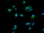 NOP58 Antibody in Immunocytochemistry (ICC/IF)