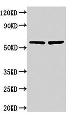 NOP58 Antibody in Western Blot (WB)