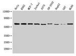 NOP58 Antibody in Western Blot (WB)