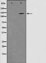 Phospho-PYK2 (Tyr580) Antibody in Western Blot (WB)