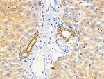 Phospho-EphA2/EphA3/EphA4 (Tyr588, Tyr596) Antibody in Immunohistochemistry (Paraffin) (IHC (P))