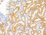 Phospho-EphA2/EphA3/EphA4 (Tyr588, Tyr596) Antibody in Immunohistochemistry (Paraffin) (IHC (P))