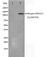 Phospho-EphA2/EphA3/EphA4 (Tyr588, Tyr596) Antibody in Western Blot (WB)