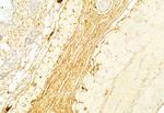 Collagen III Antibody in Immunohistochemistry (Paraffin) (IHC (P))