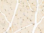 E2F4 Antibody in Immunohistochemistry (Paraffin) (IHC (P))