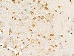 E2F4 Antibody in Immunohistochemistry (Paraffin) (IHC (P))