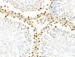 E2F4 Antibody in Immunohistochemistry (Paraffin) (IHC (P))