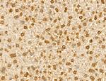 E2F4 Antibody in Immunohistochemistry (Paraffin) (IHC (P))