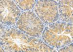 FGFR1OP Antibody in Immunohistochemistry (Paraffin) (IHC (P))