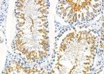 FGFR1OP Antibody in Immunohistochemistry (Paraffin) (IHC (P))