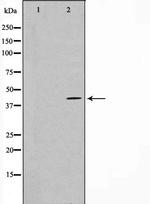 FGFR1OP Antibody in Western Blot (WB)