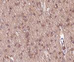 mGluR2/mGluR3 Antibody in Immunohistochemistry (Paraffin) (IHC (P))